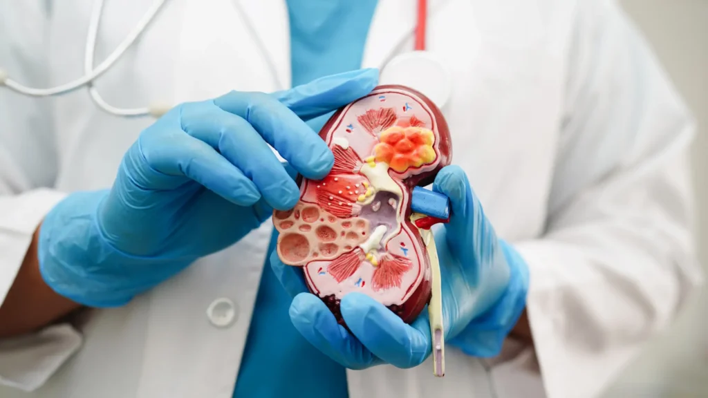 Advanced kidney transplant surgery with expert care and high success rates.